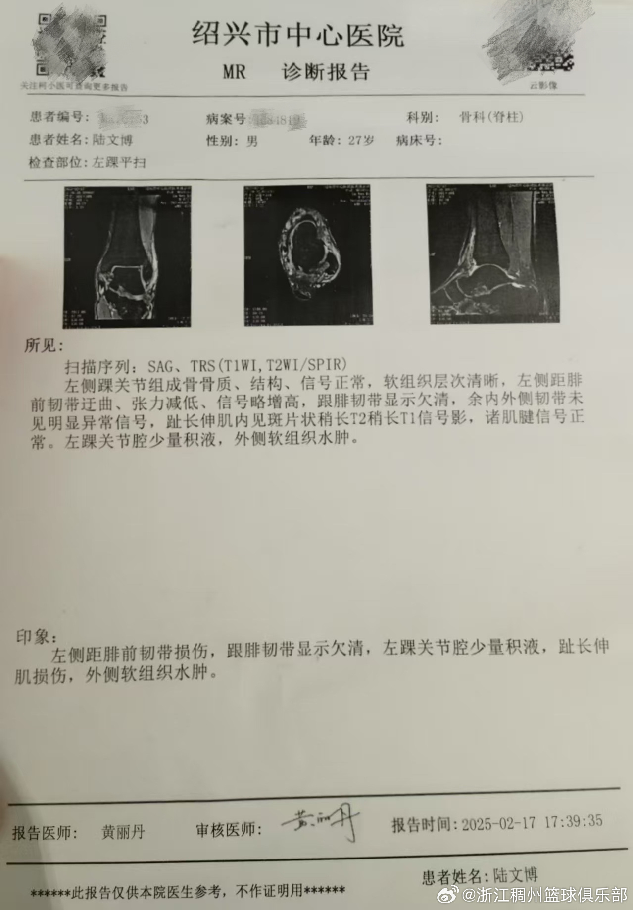 变能力